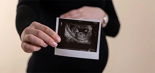 My Junior Kinderwagen Die Schwangerschaft verkünden – Wann ist der richtige Zeitpunkt gekommen?